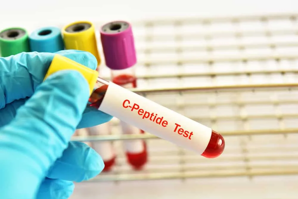 C-PEPTIDE-TEST