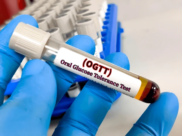 Oral Glucose Tolerance Test (OGTT)