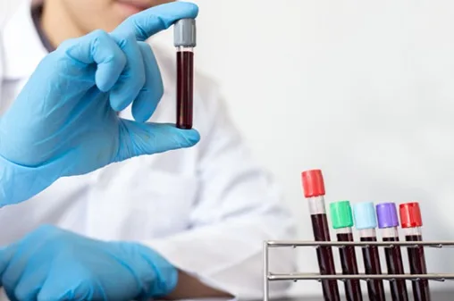 Discounted Laboratory Tests in Sharjah