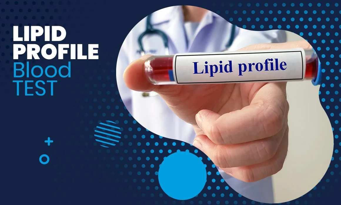 lipid profile test