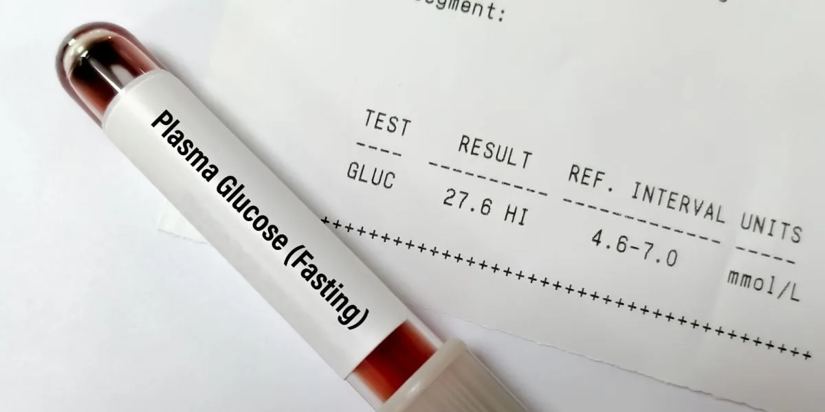 plasma-fasting-glucose