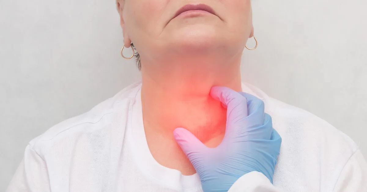 Thyroid Nodules and Goiter